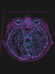 Height elevated contour map, brain dataset, rotated
